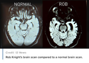 Rob Brain